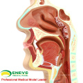 THROAT04 (12508) Modelo de secção de cavidades nasais de patologia, tamanho normal, modelos de cavidades nasais